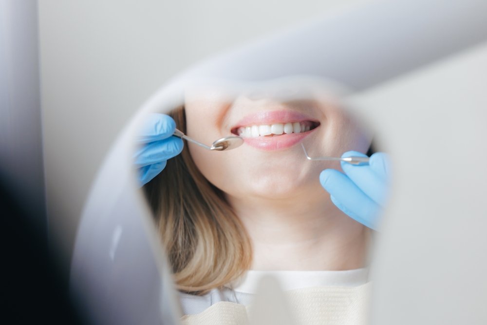 Teeth Whitening — what to know