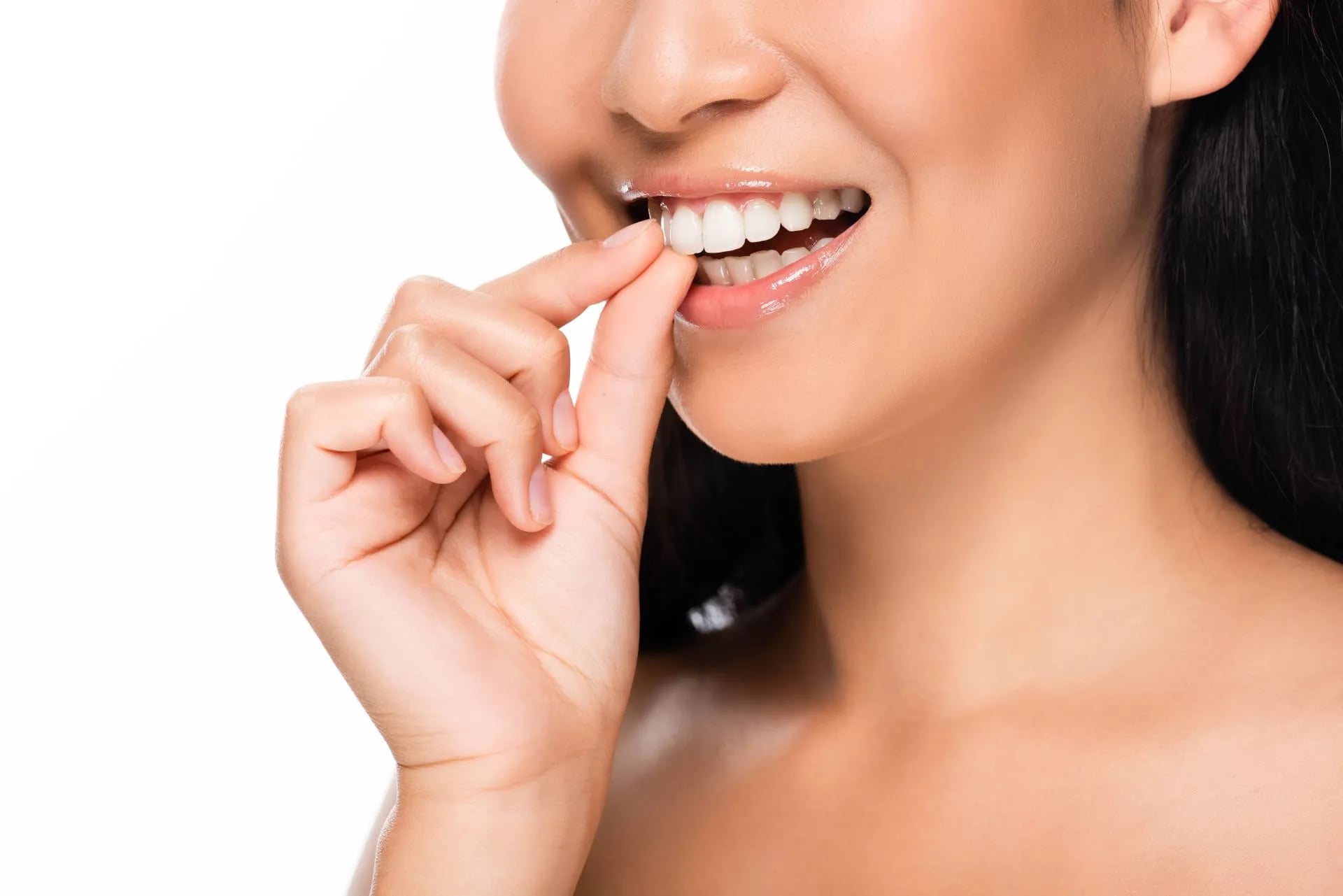 Veneers — what to know