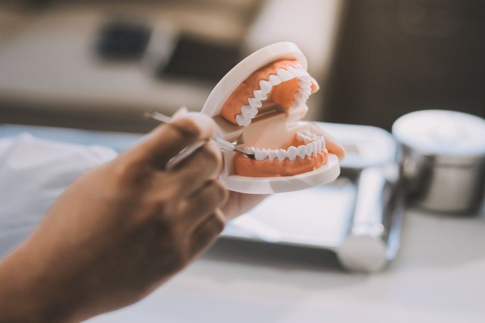 Dental Fillings — our approach